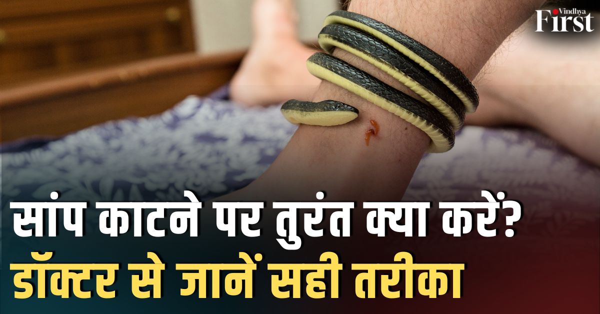 Monsoon Special: सांप काटने पर तुरंत क्या करें? डॉक्टर से जानें सही तरीका