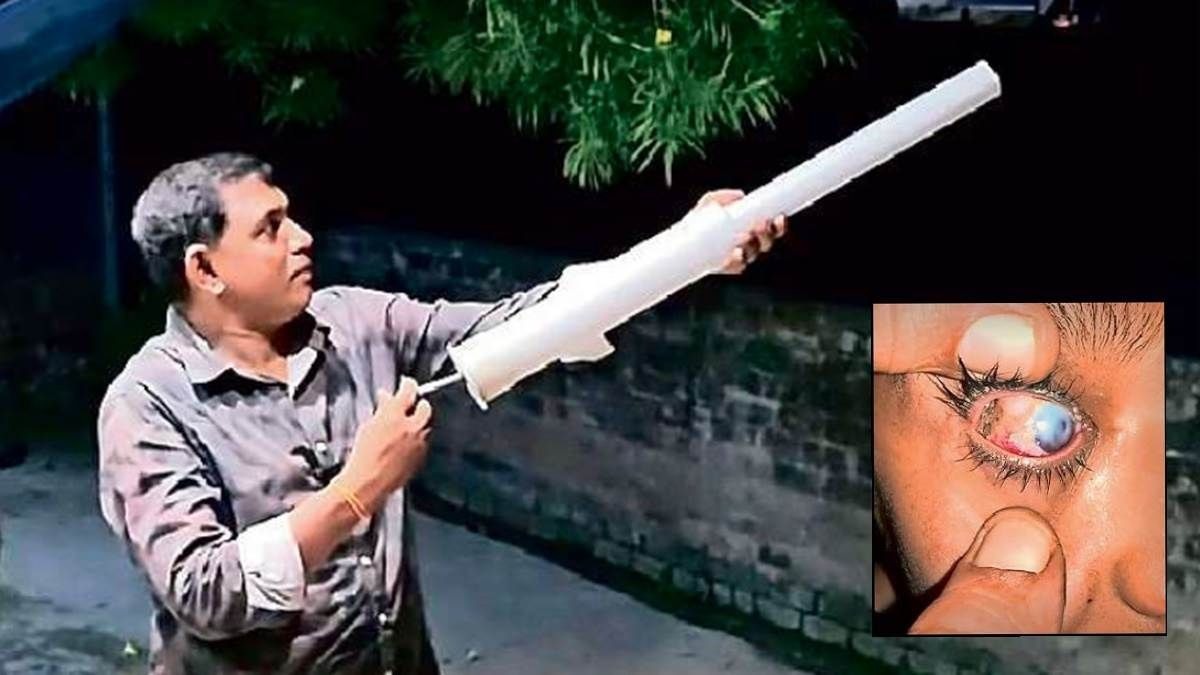MP में कार्बाइड गन हादसा: दिवाली का जश्न 14 बच्चों की आंखों की रोशनी पर भारी