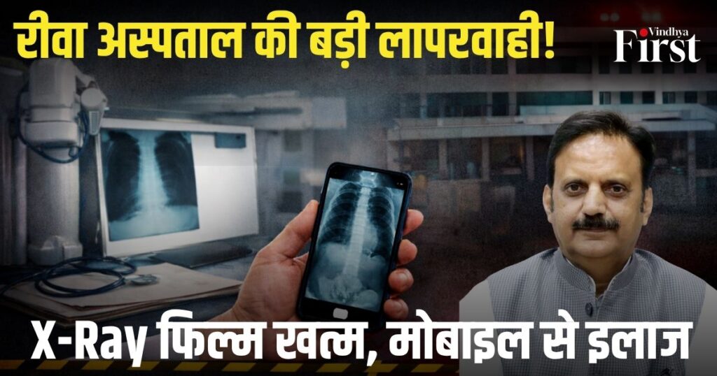 रीवा के सुपर स्पेशलिटी अस्पताल की बदहाल व्यवस्था ने स्वास्थ्य सिस्टम पर सवाल खड़े कर दिए हैं. X-Ray फिल्म खत्म होने के कारण मरीजों को मोबाइल से फोटो खींचकर रिपोर्ट दी जा रही है और डॉक्टर उसी से इलाज कर रहे हैं